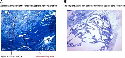 A Process for the Design and Development of Novel Bone Morphogenetic Protein-7 (BMP-7) Mimetics With an Example: THR-184